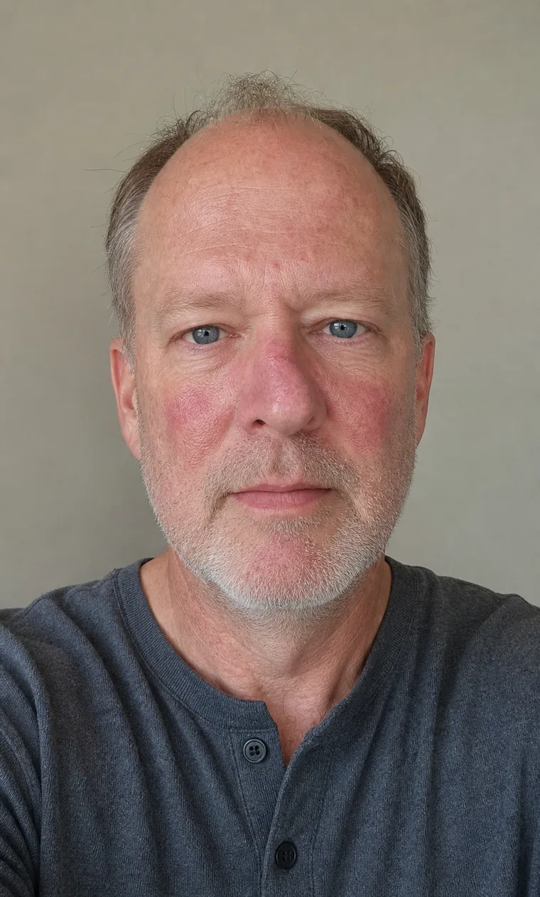 Synthetic source portrait for case 10, a 52-year-old white man